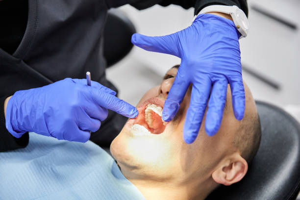 Best Emergency Tooth Extraction in West Mountain, UT